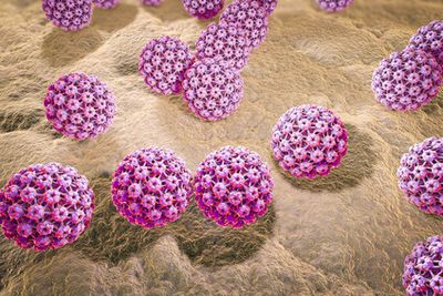 Papillomavirus gebarmutterhals - Cum arată condiloamele largi