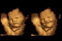 4D-Ultraschallbilder von einem Fetus