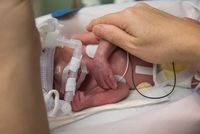 Mutter streichelt Frühchen im Inkubator