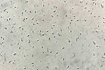Spermien unterm Mikroskop